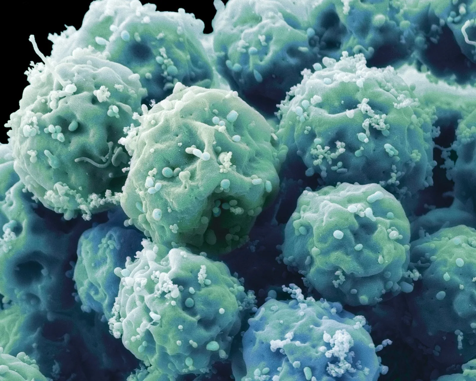 Stem Cells